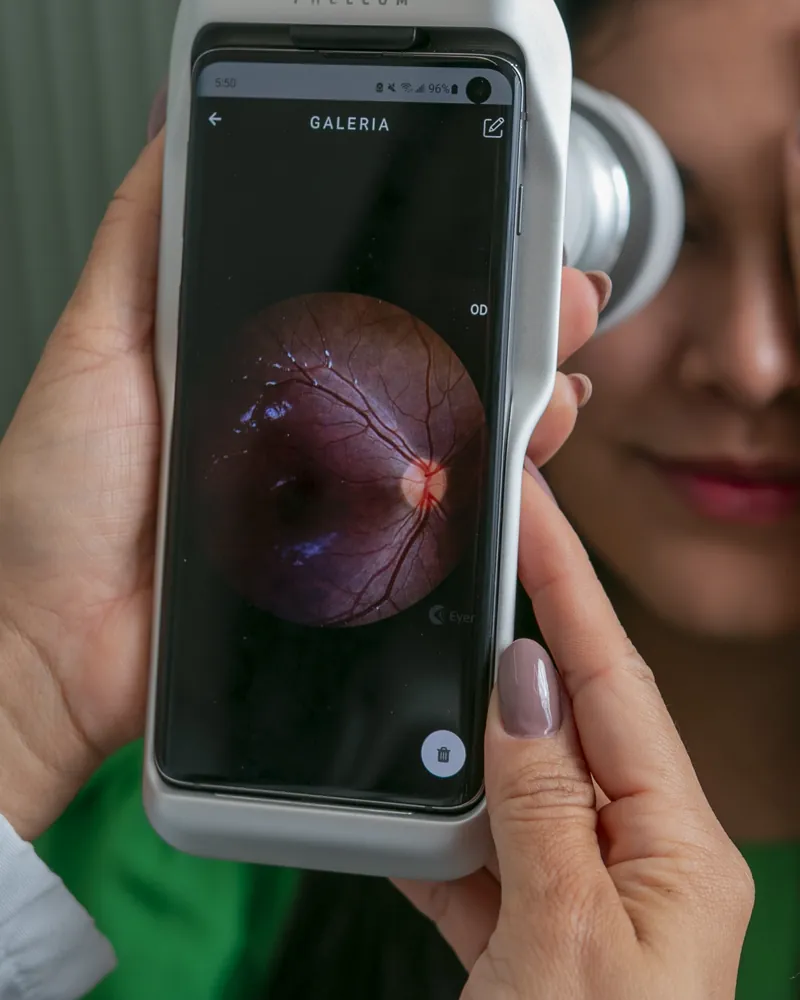 Retinógrafo portátil encostado ao olho da paciente, com a imagem da retina na tela